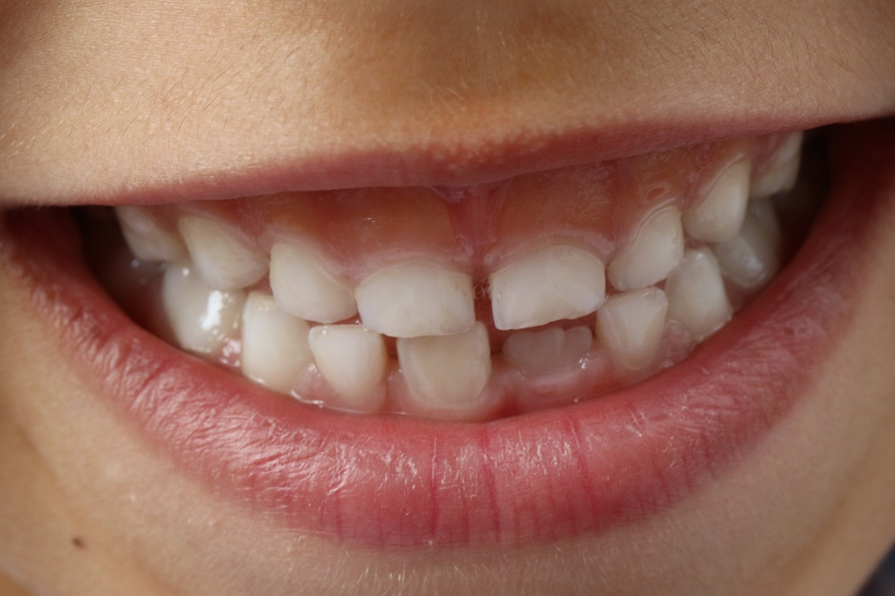 Gesunde Zähne von Anfang an